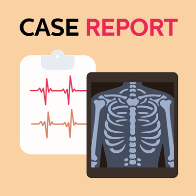 [Case Report] 47yo with rapidly progressive respiratory failure requiring ECMO